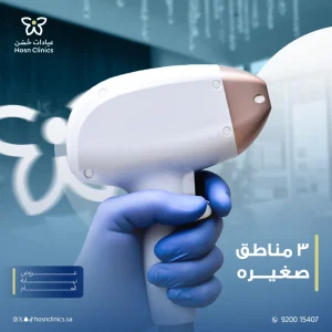 3 مناطق صغيره