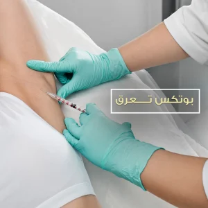 بوتكس التعرق