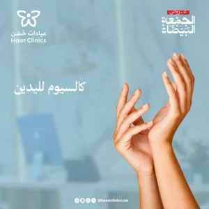 كالسيوم لليدين